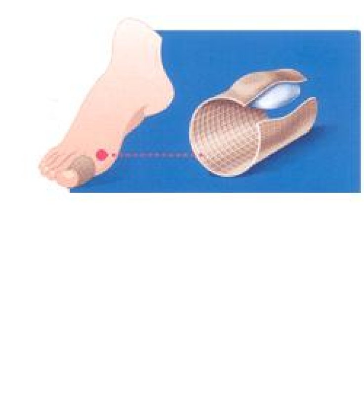 PODOGEL Anello Dita L 1pz